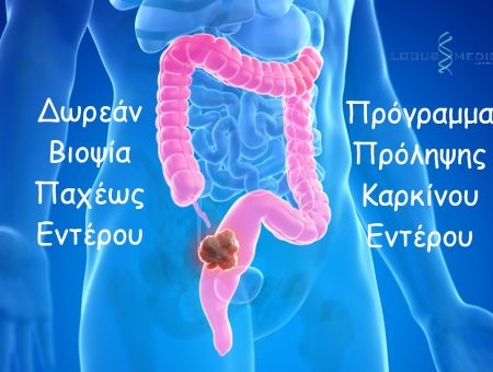 Το Locus Medicus συμμετέχει στο Πρόγραμμα Πρόληψης Καρκίνου του Παχέως Εντέρου με δωρεάν βιοψίες