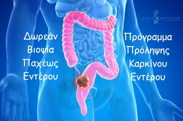 Το Locus Medicus συμμετέχει στο Πρόγραμμα Πρόληψης Καρκίνου του Παχέως Εντέρου με δωρεάν βιοψίες